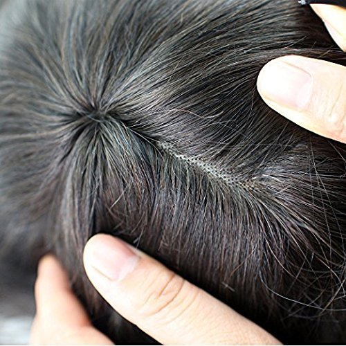 Los Angles Hair Patch - Image 3